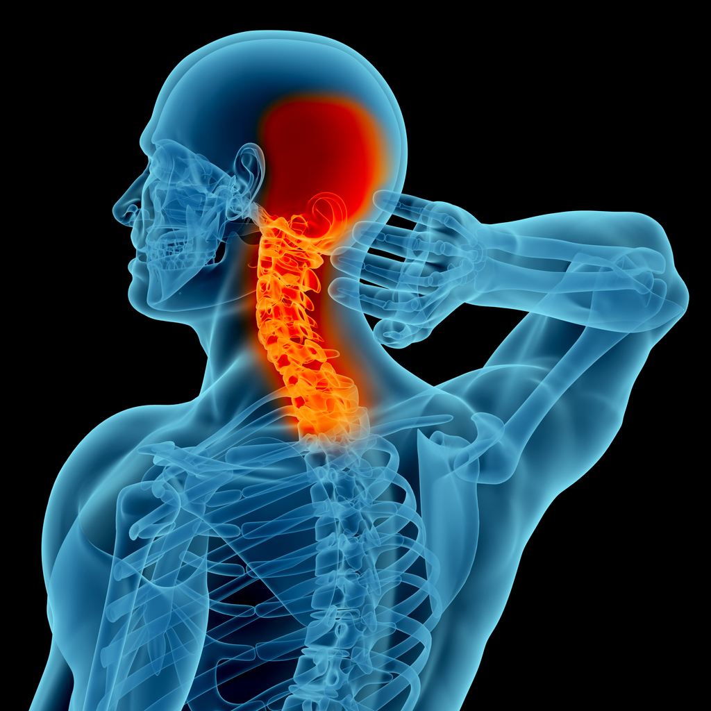 Anatomy of cervicogenic headache referral patterns