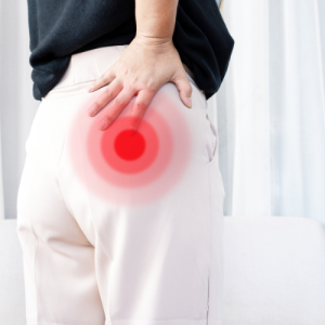 Gluteal Tendinopathy illustration
