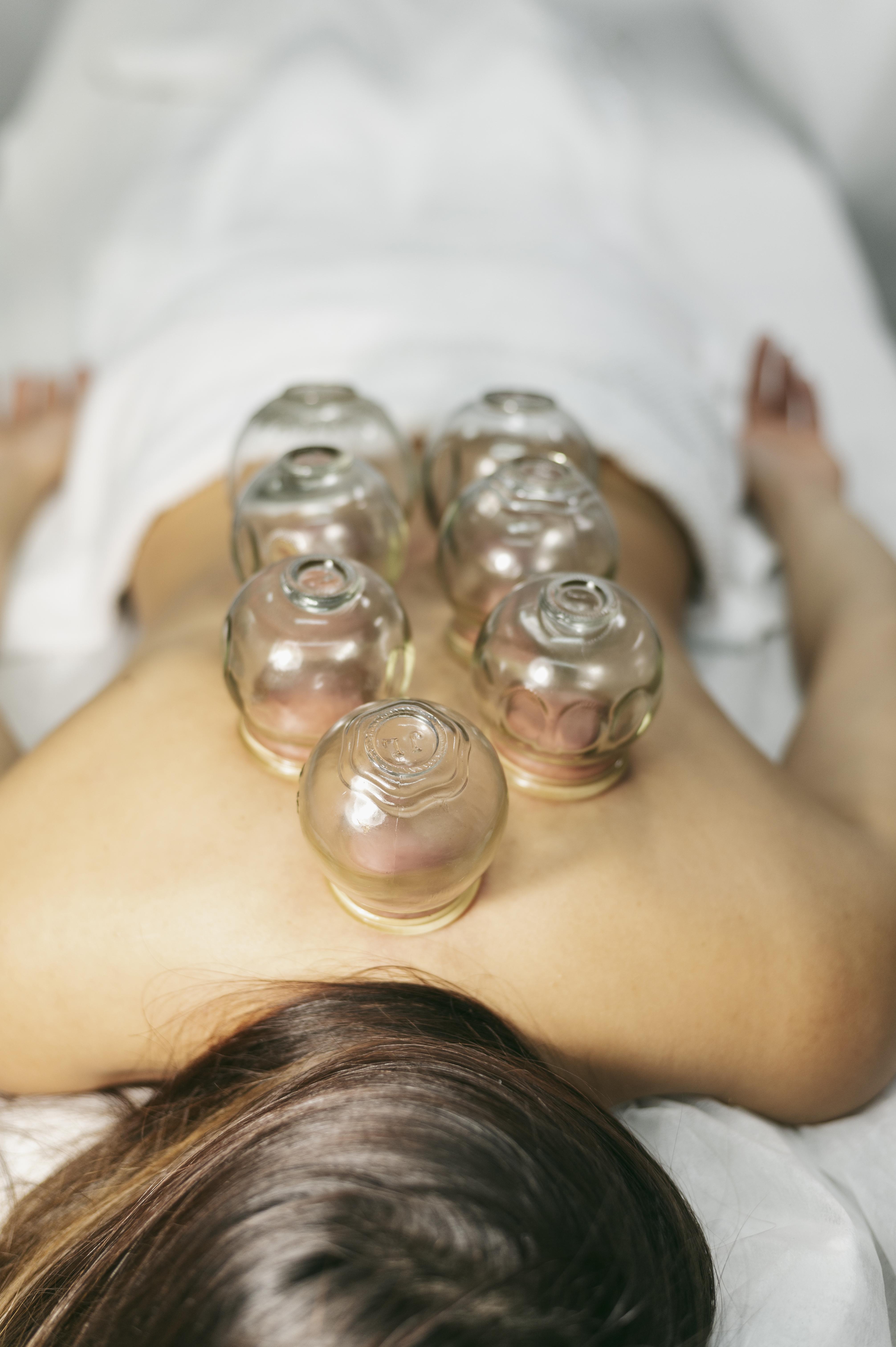 Cupping Therapy